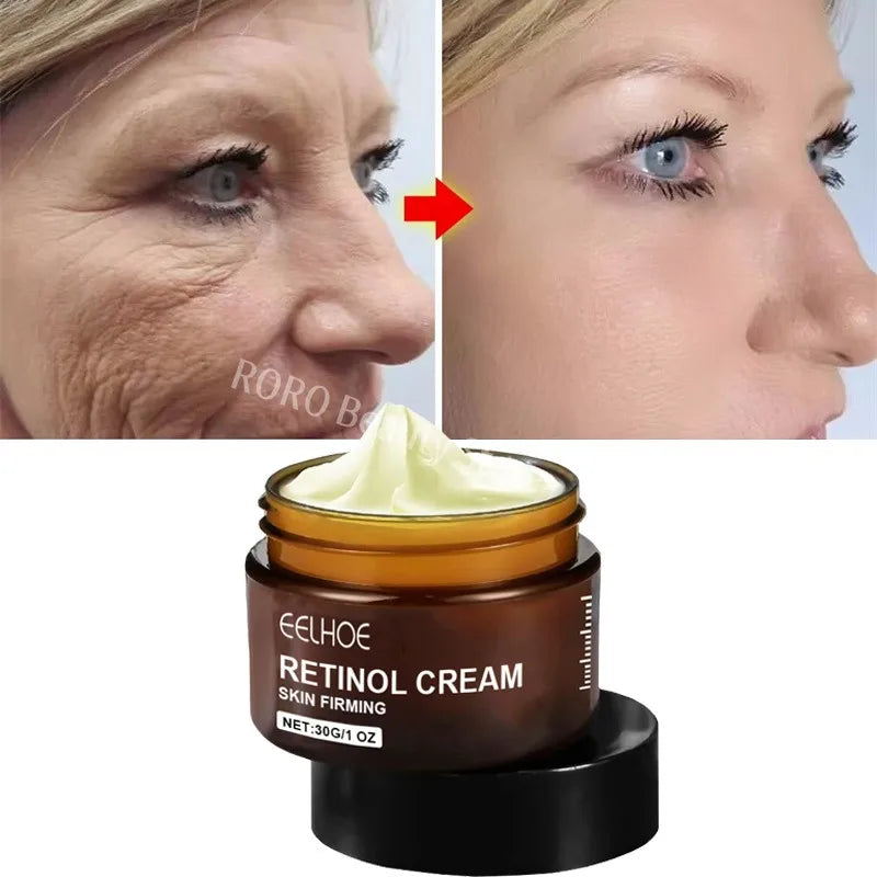 Retinol Wrinkle Remover Face Set Instant Firming Lifting Anti-Aging Serum Fade Fine Lines Whitening Korean Skin Care Products